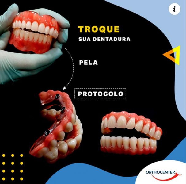 Prótese Protocolo: Entenda o que é e os diferenciais dessa técnica